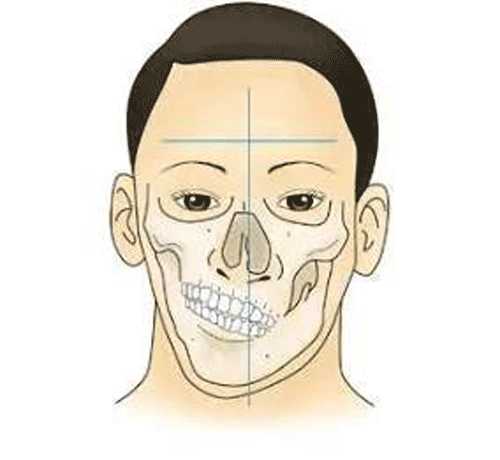 广州正畸陈奇医生 的想法: 【面容不对称—偏頜,可以通过牙齿矫正改… - 知乎