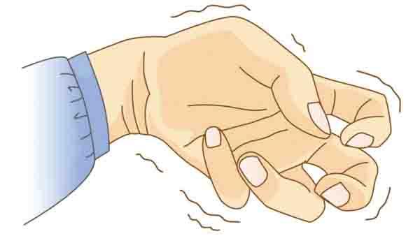 书写痉挛患者坚持下去 对自己负责 更是对未来负责 - 知乎